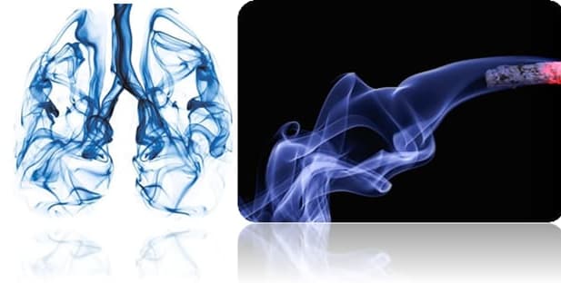 Mortalità per tumore del Polmone attribuibile al tabacco, in Italia 1990-2017