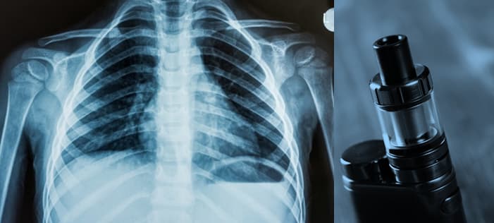 L’eterogeneità dei casi fa pensare all’inalazione di  sostanze tossiche